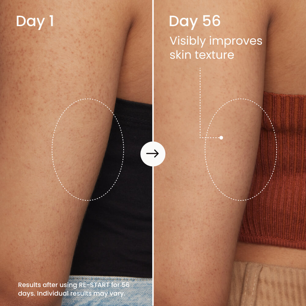 Resurfacing Body Serum product